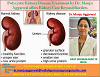 For example: Strategic consulting new york Polycystic Kidney Disease Treatment by Dr. Manju Aggarwal